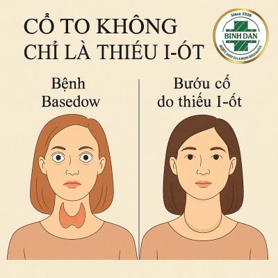 Bướu cổ là một biểu hiện phổ biến của các bệnh tuyến giáp, nhưng không phải trường hợp nào cổ to cũng do thiếu i-ốt. Trên thực tế, nhiều người dễ nhầm lẫn giữa bướu cổ do thiếu i-ốt và bệnh Basedow (cường giáp tự miễn) – một bệnh lý nội tiết nguy hiểm nếu không được điều trị kịp thời. Bài viết này sẽ giúp bạn phân biệt Basedow và bướu cổ do thiếu i-ốt thông qua các dấu hiệu, nguyên nhân và phương pháp điều trị, từ đó đưa ra hướng xử lý đúng cách.